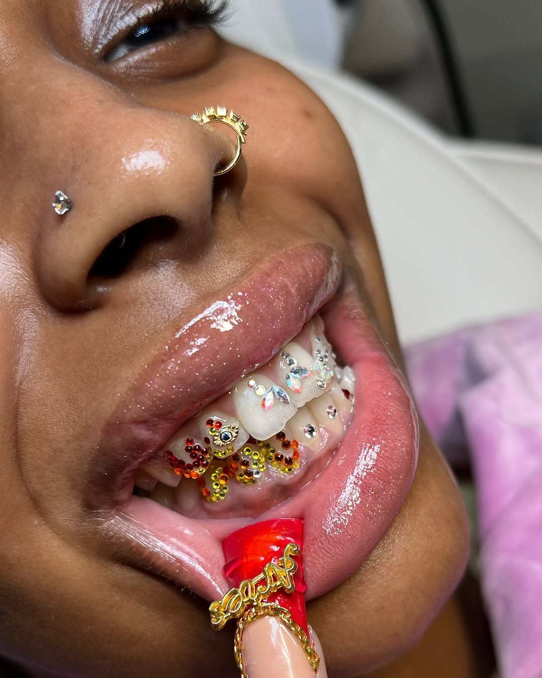 Post 3 by B.T.M | LONDON TOOTH GEMS | TEETH WHITENING | GRILLZ on Instagram (carousel)
