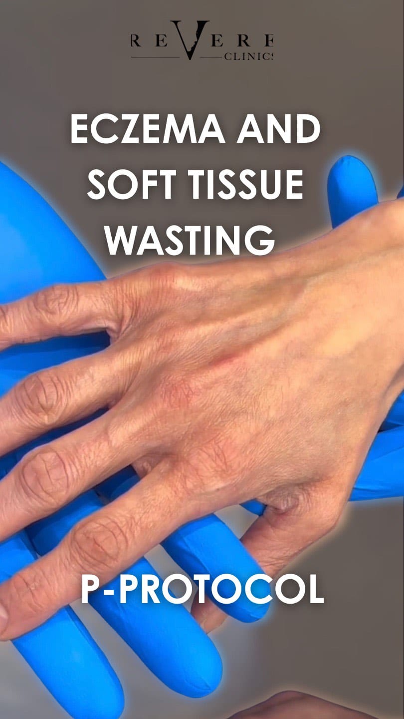 Post 9 by Revere Clinics® on Instagram (video)