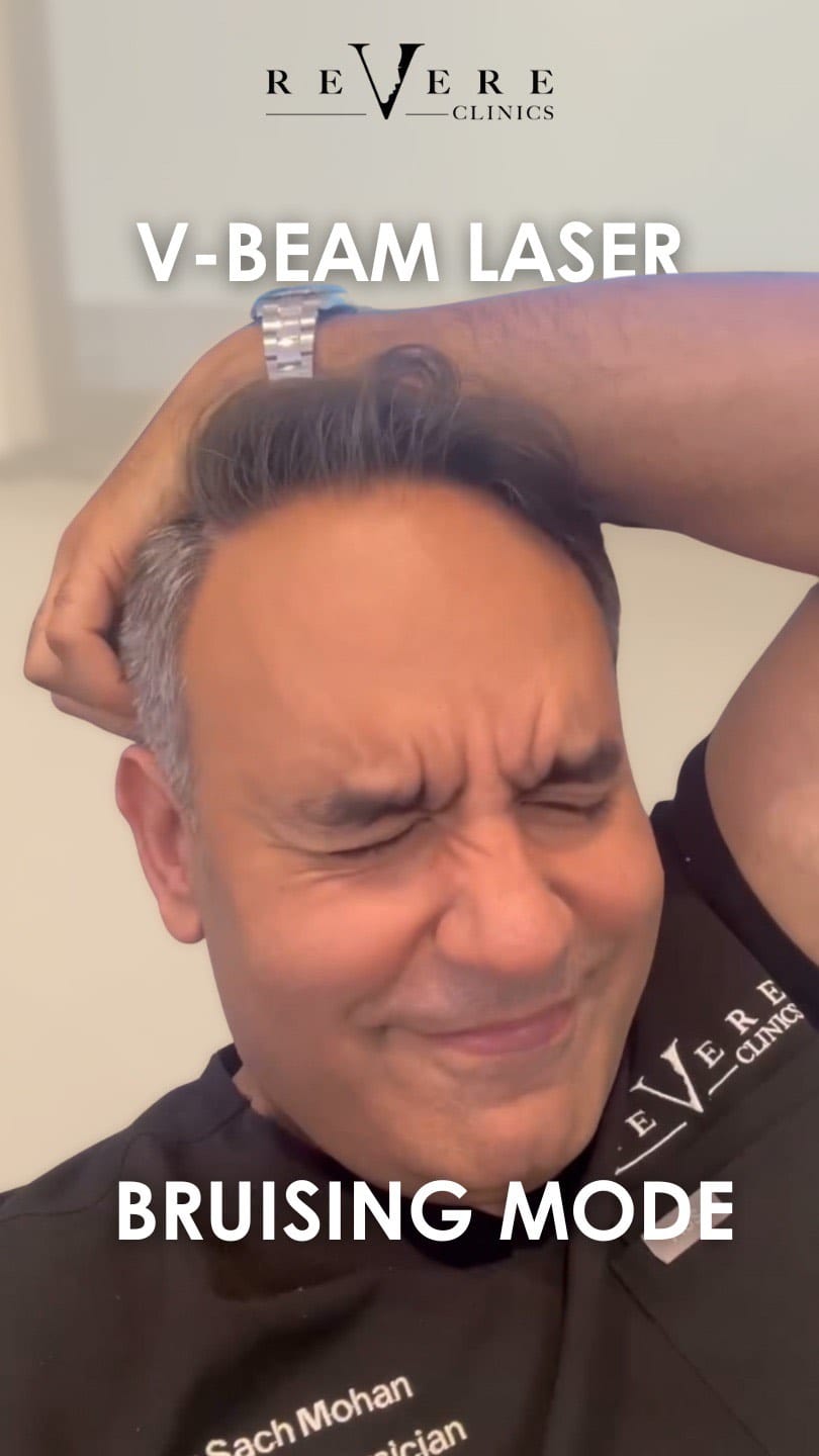 Post 8 by Revere Clinics® on Instagram (video)