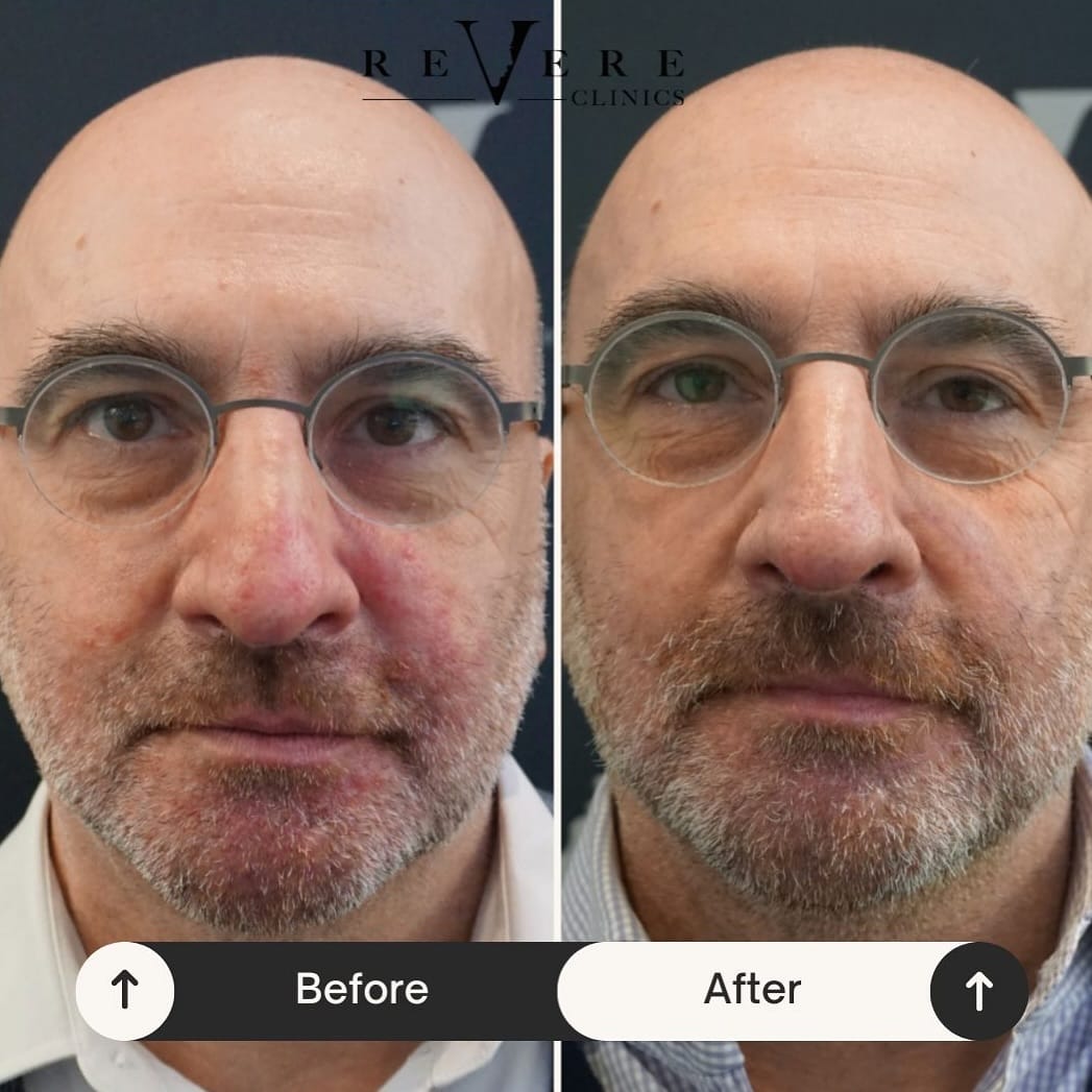 Post 7 by Revere Clinics® on Instagram (image)