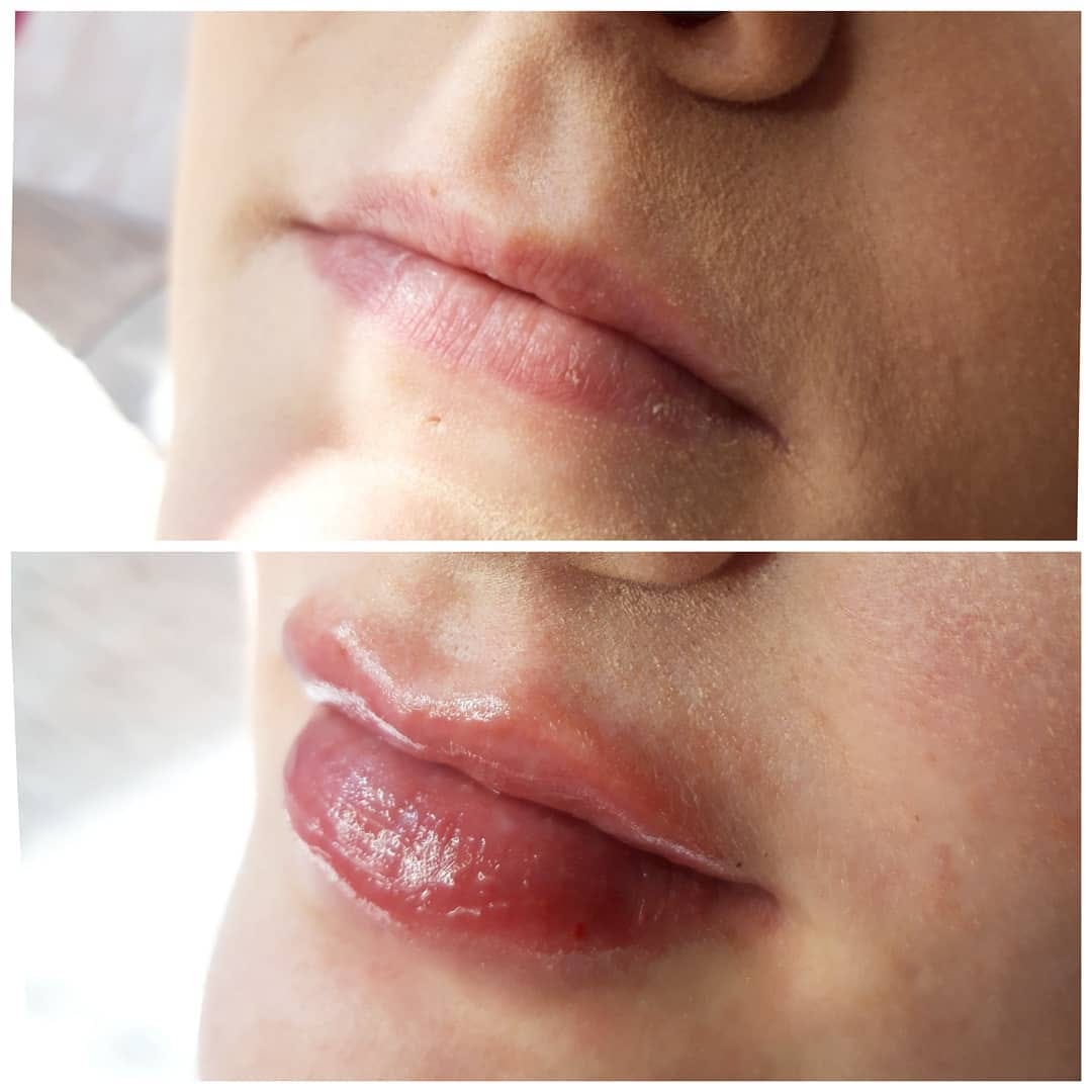 Post 4 by Ellas enhancements on Instagram (image)