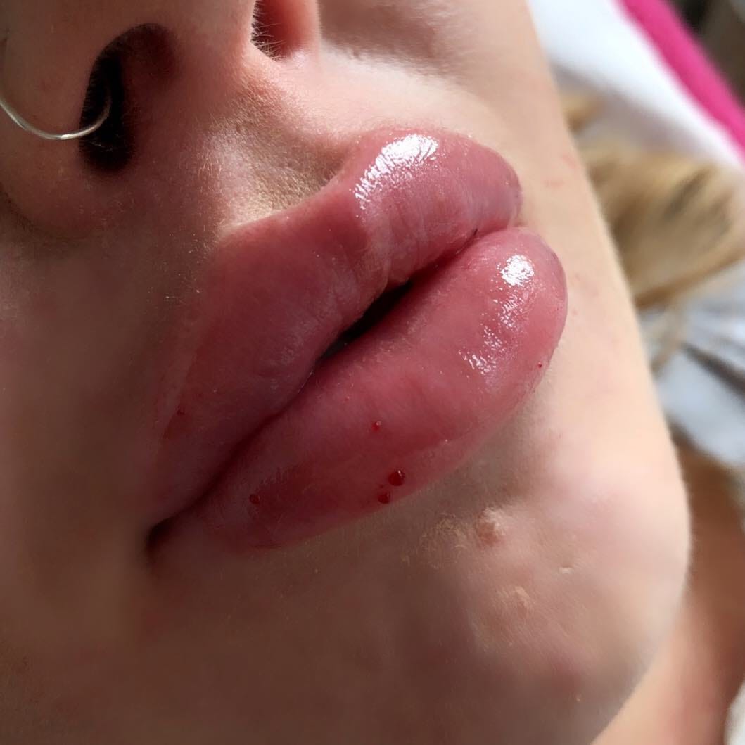 Post 9 by Ellas enhancements on Instagram (image)