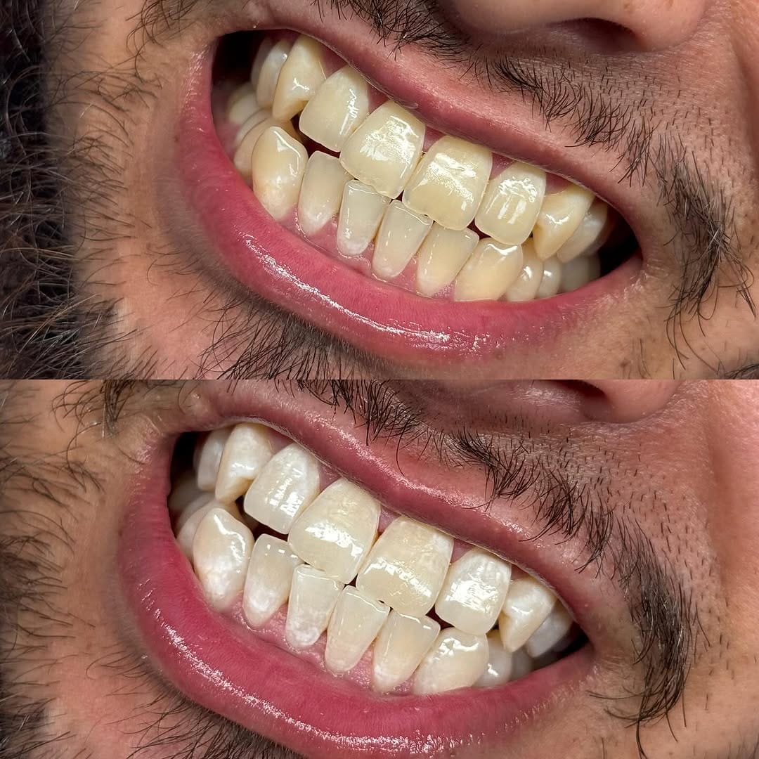 Post 7 by @_facesthetics on Instagram (image)