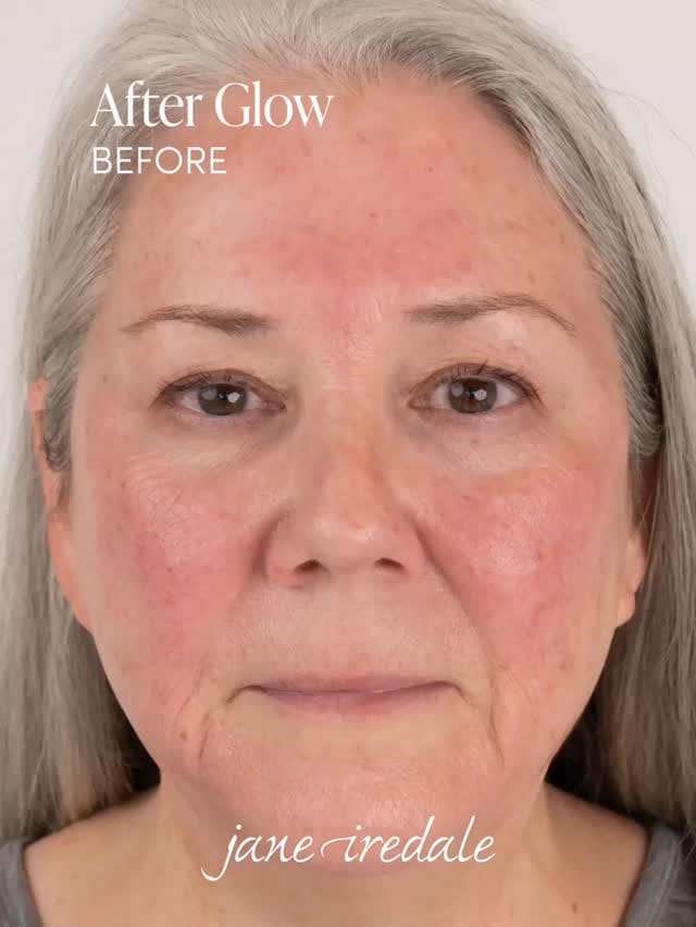 Post 1 by Healthxchange UK & Ireland | Aesthetics & Skincare on Instagram (video)