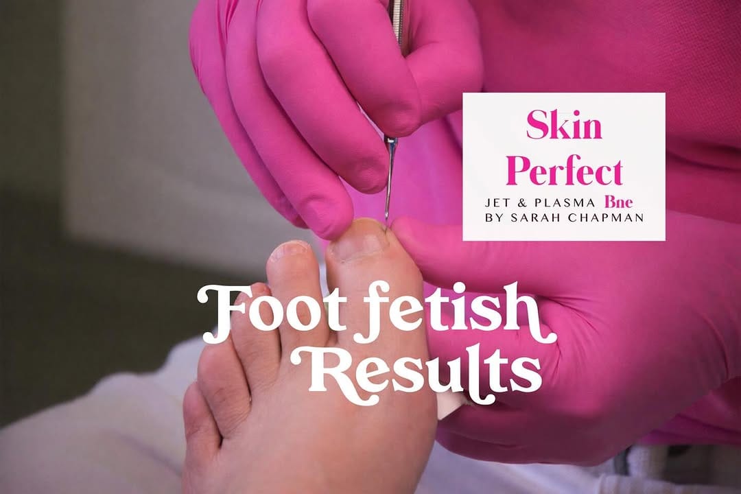 Post 3 by Sarah Chapman | Skin Tightening & Facelifts on Instagram (carousel)