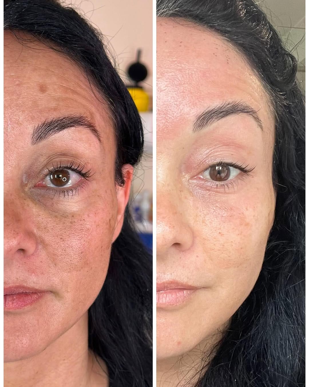 Post 9 by Sarah Chapman | Skin Tightening & Facelifts on Instagram (carousel)