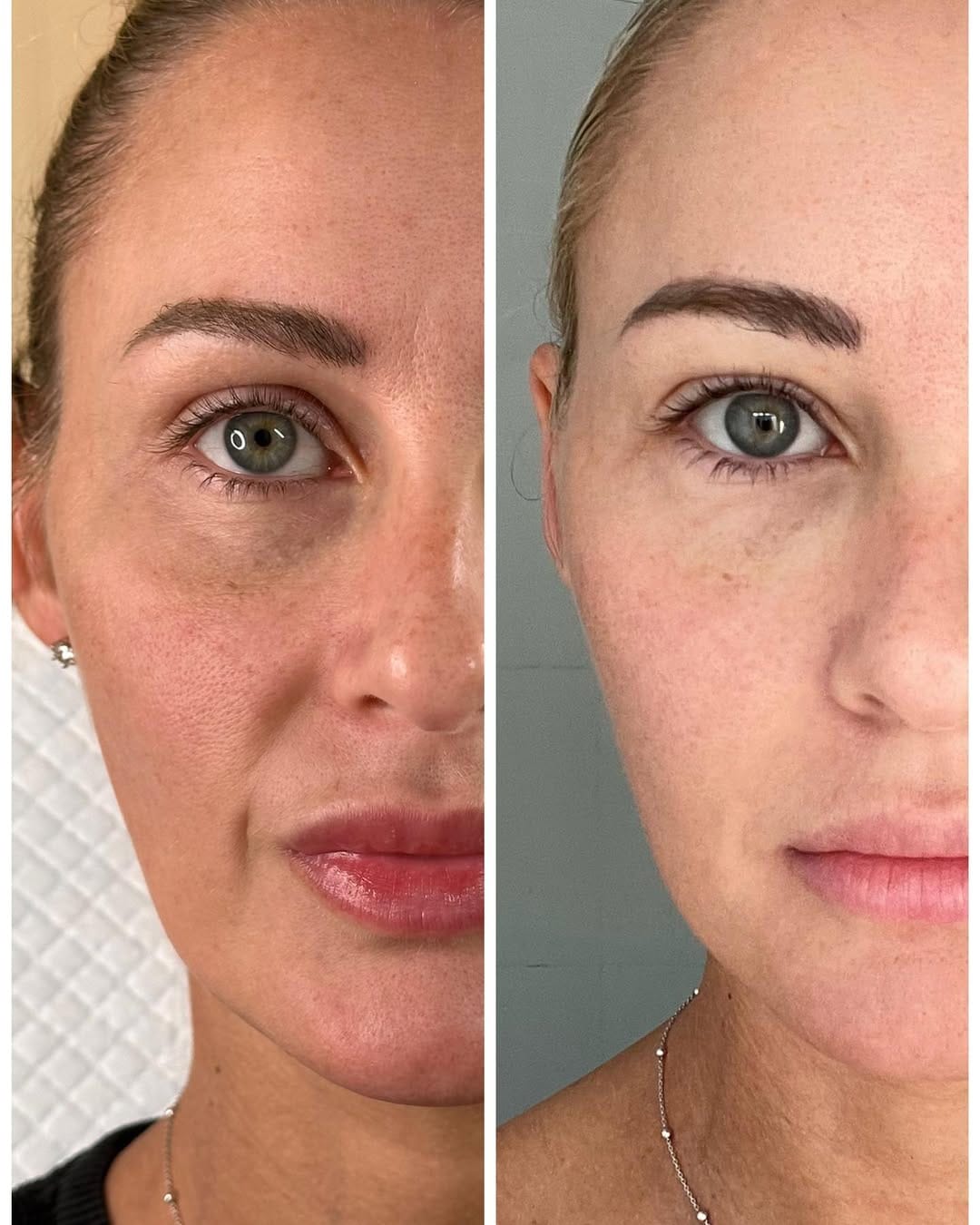 Post 10 by Sarah Chapman | Skin Tightening & Facelifts on Instagram (carousel)