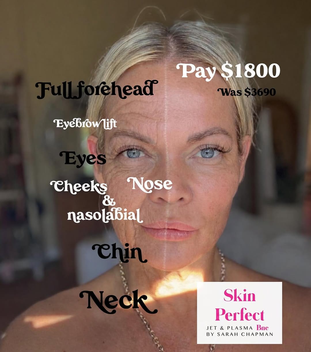 Post 8 by Sarah Chapman | Skin Tightening & Facelifts on Instagram (carousel)