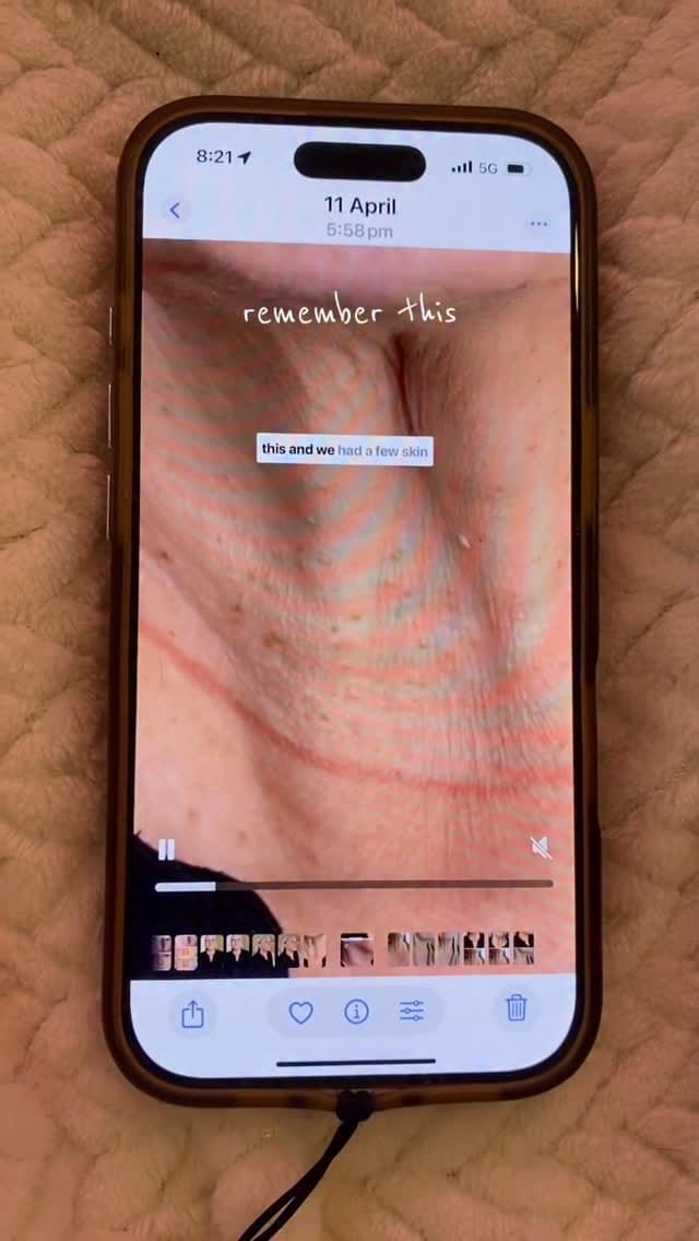 Post 2 by Sarah Chapman | Skin Tightening & Facelifts on Instagram (video)