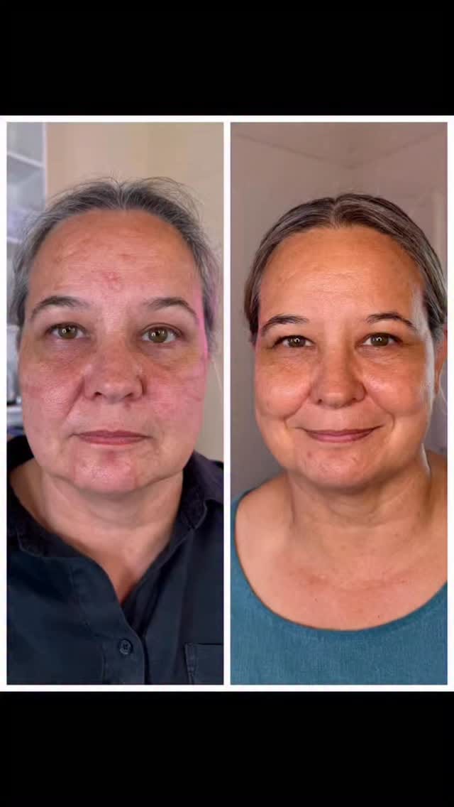 Post 1 by Sarah Chapman | Skin Tightening & Facelifts on Instagram (video)