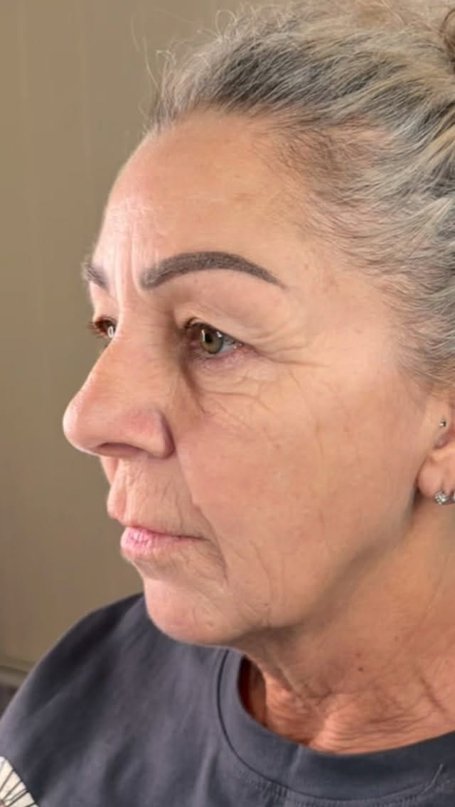 Post 4 by Sarah Chapman | Skin Tightening & Facelifts on Instagram (video)