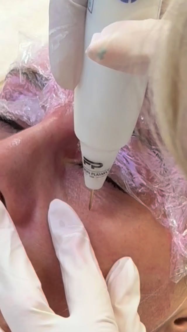 Post 6 by Sarah Chapman | Skin Tightening & Facelifts on Instagram (video)