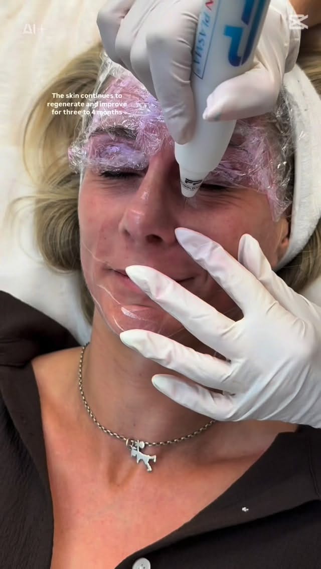 Post 7 by Sarah Chapman | Skin Tightening & Facelifts on Instagram (video)