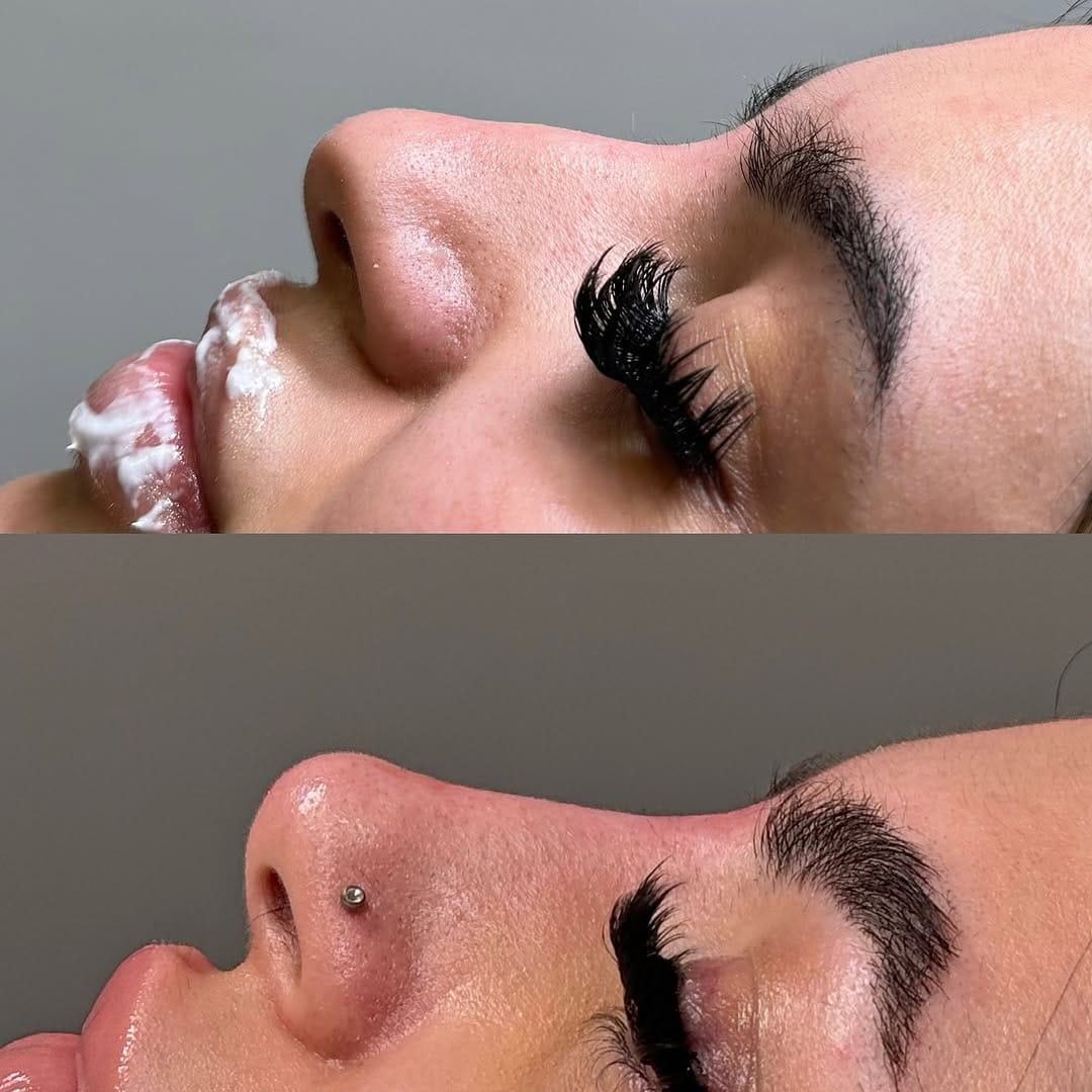 Post 9 by Inara Babamir | Piercer & Cosmetic Injector on Instagram (image)