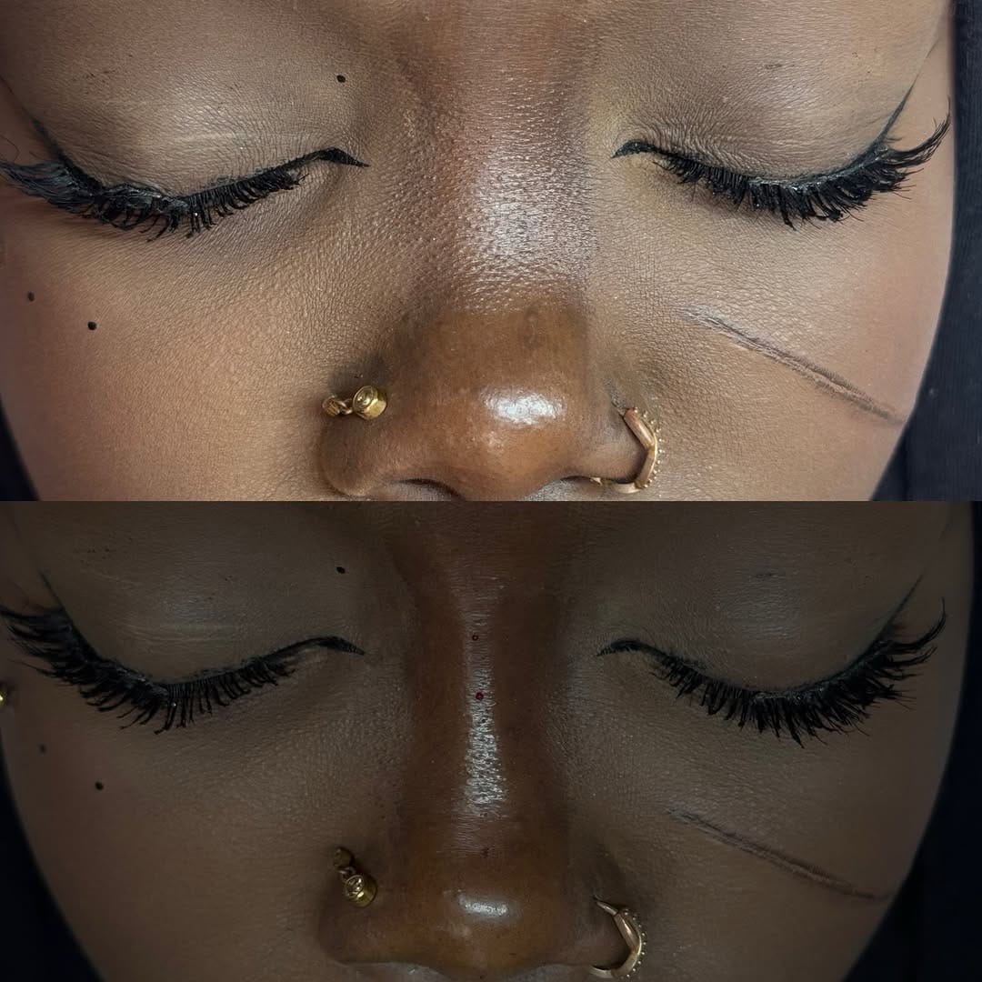Post 3 by Inara Babamir | Piercer & Cosmetic Injector on Instagram (carousel)