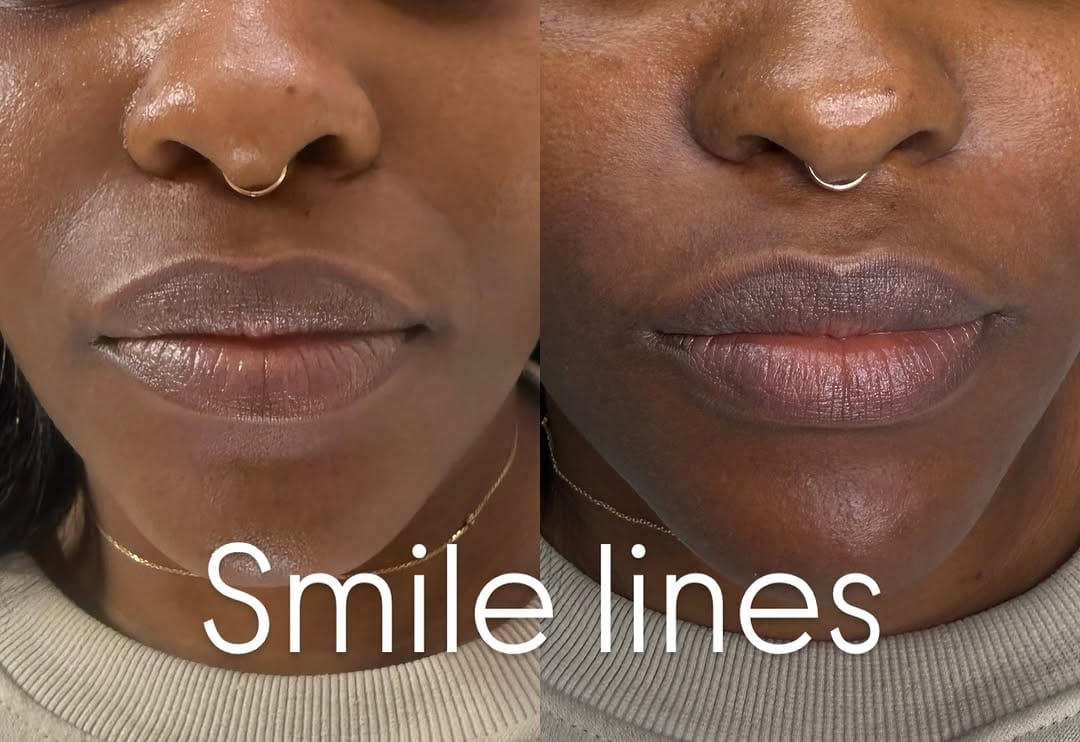 Post 2 by PMU & LASH ARTIST | TRAINING on Instagram (image)