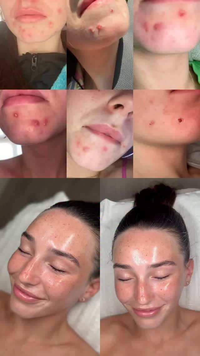 Post 9 by Sam | Liverpool Skincare Specialist on Instagram (video)