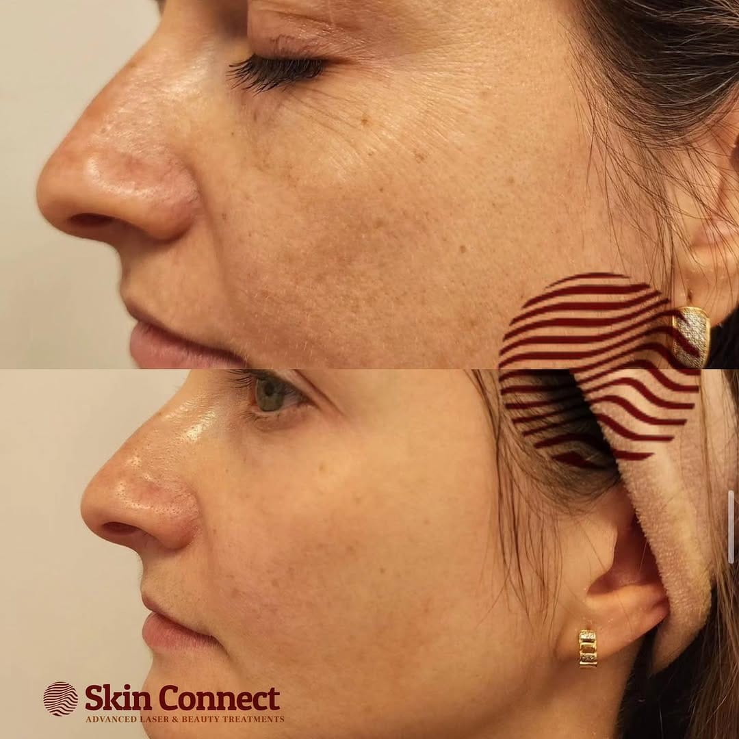 Post 3 by Laser Hair & Skin Clinic on Instagram (image)