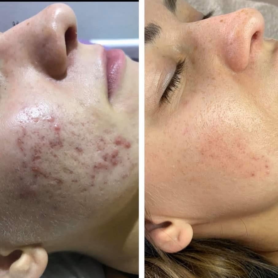 Post 9 by Skin By Katy Spelzini on Instagram (image)