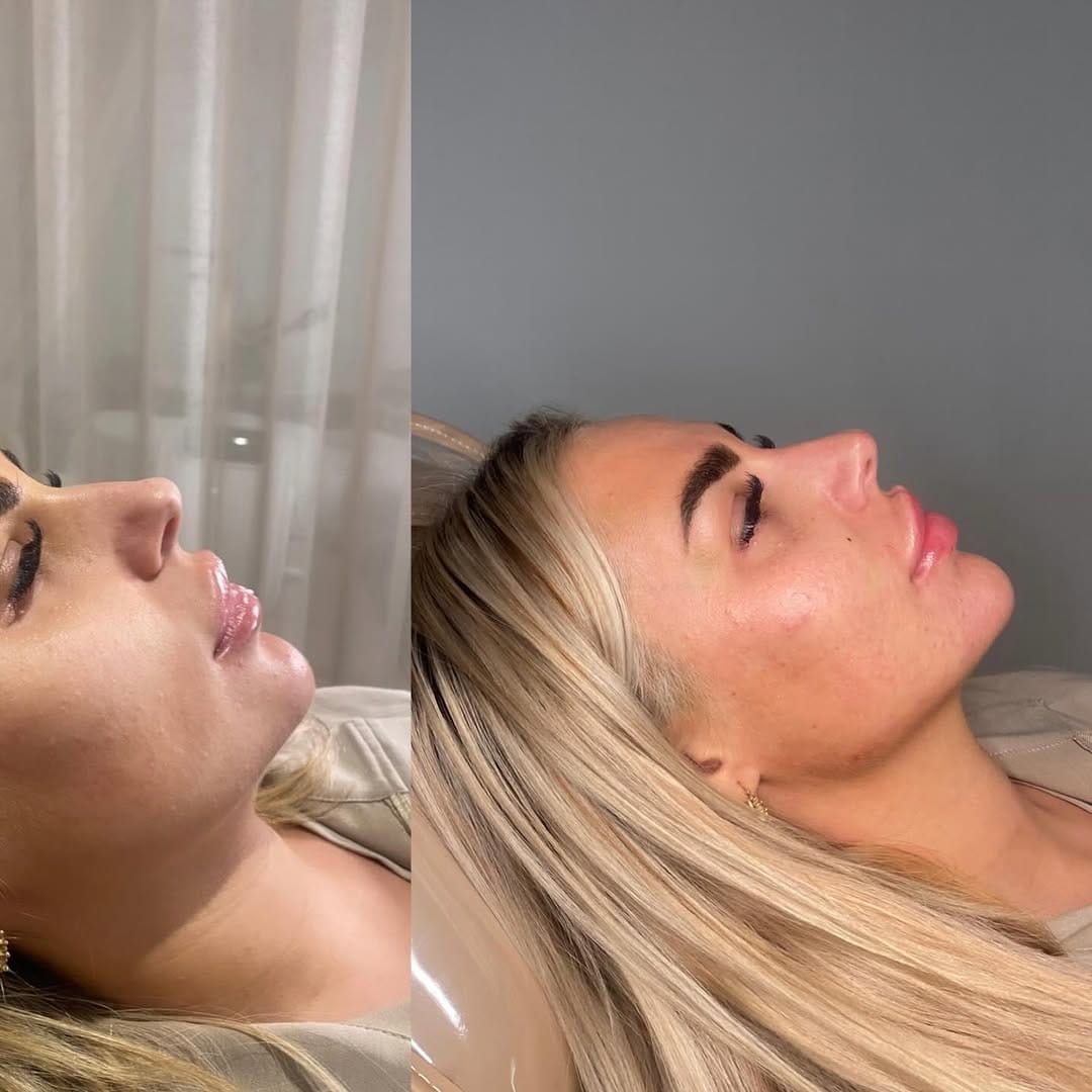 Post 7 by Gigi Aesthetics Training Academy on Instagram (image)