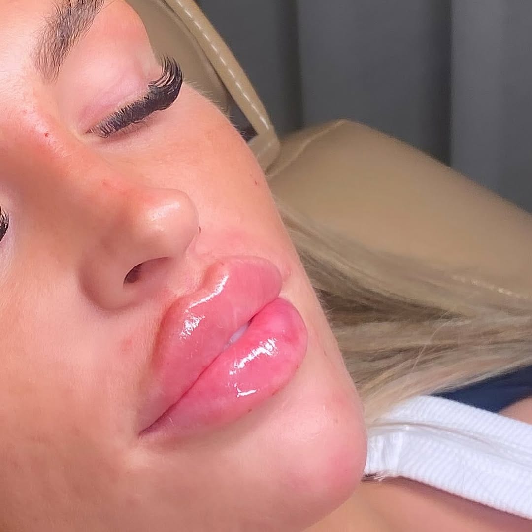 Post 10 by Gigi Aesthetics Training Academy on Instagram (image)