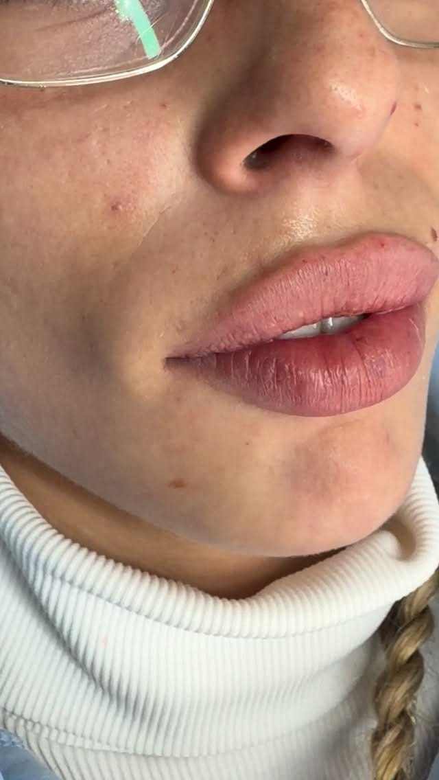Post 2 by ANNABELLES AESTHETICS ACADEMY on Instagram (video)