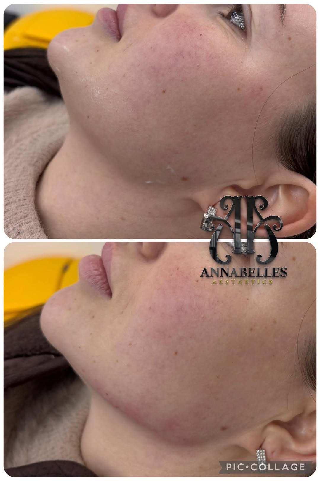 Post 6 by ANNABELLES AESTHETICS ACADEMY on Instagram (image)