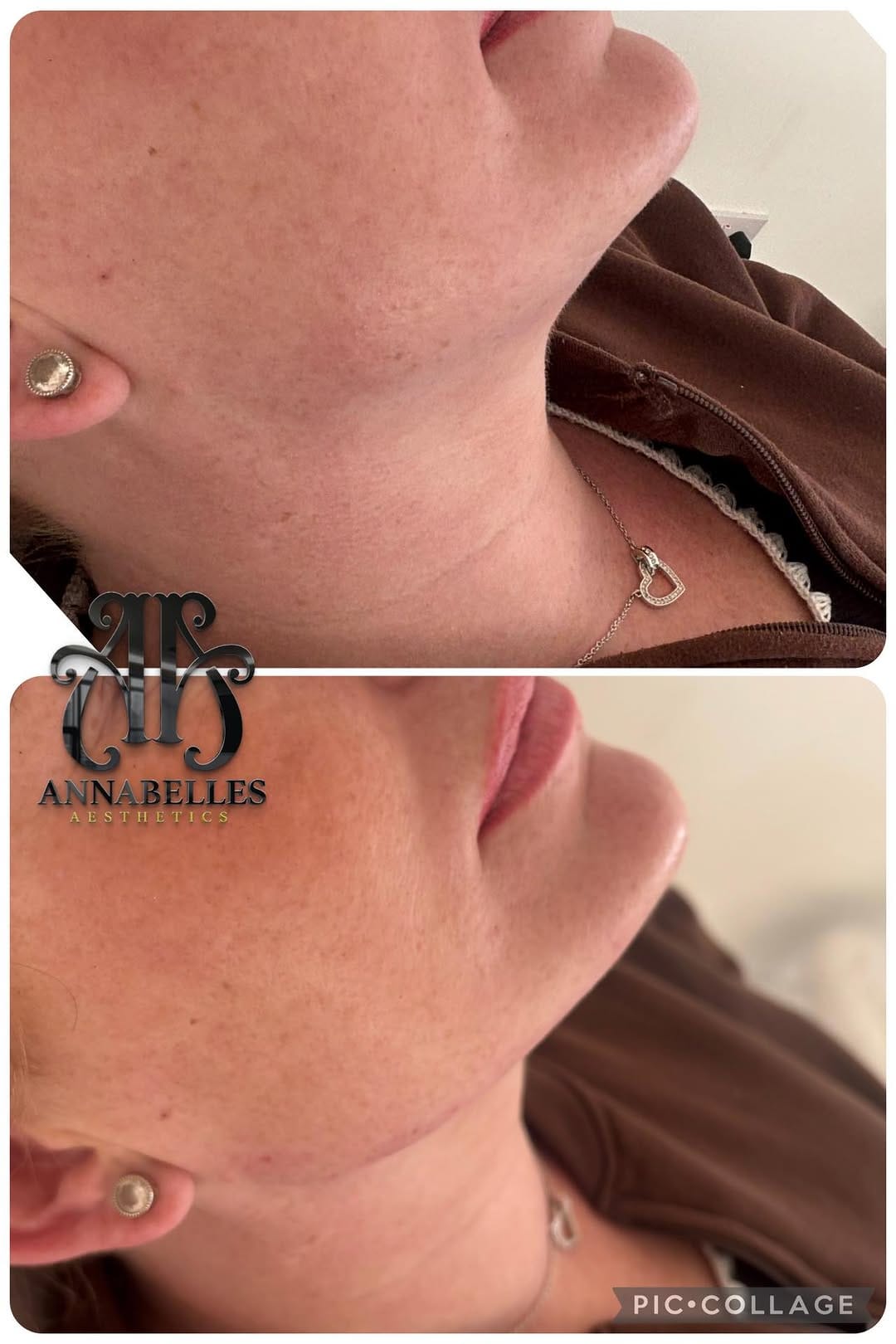 Post 8 by ANNABELLES AESTHETICS ACADEMY on Instagram (image)