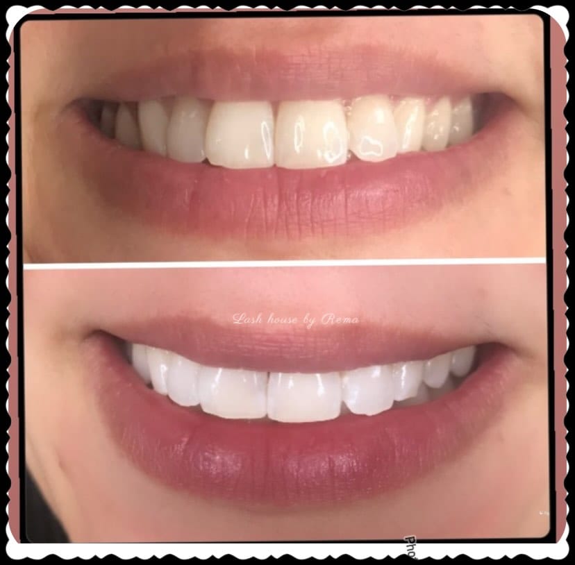Post 3 by Beauty care/ lash/ brow / London Ont on Instagram (image)
