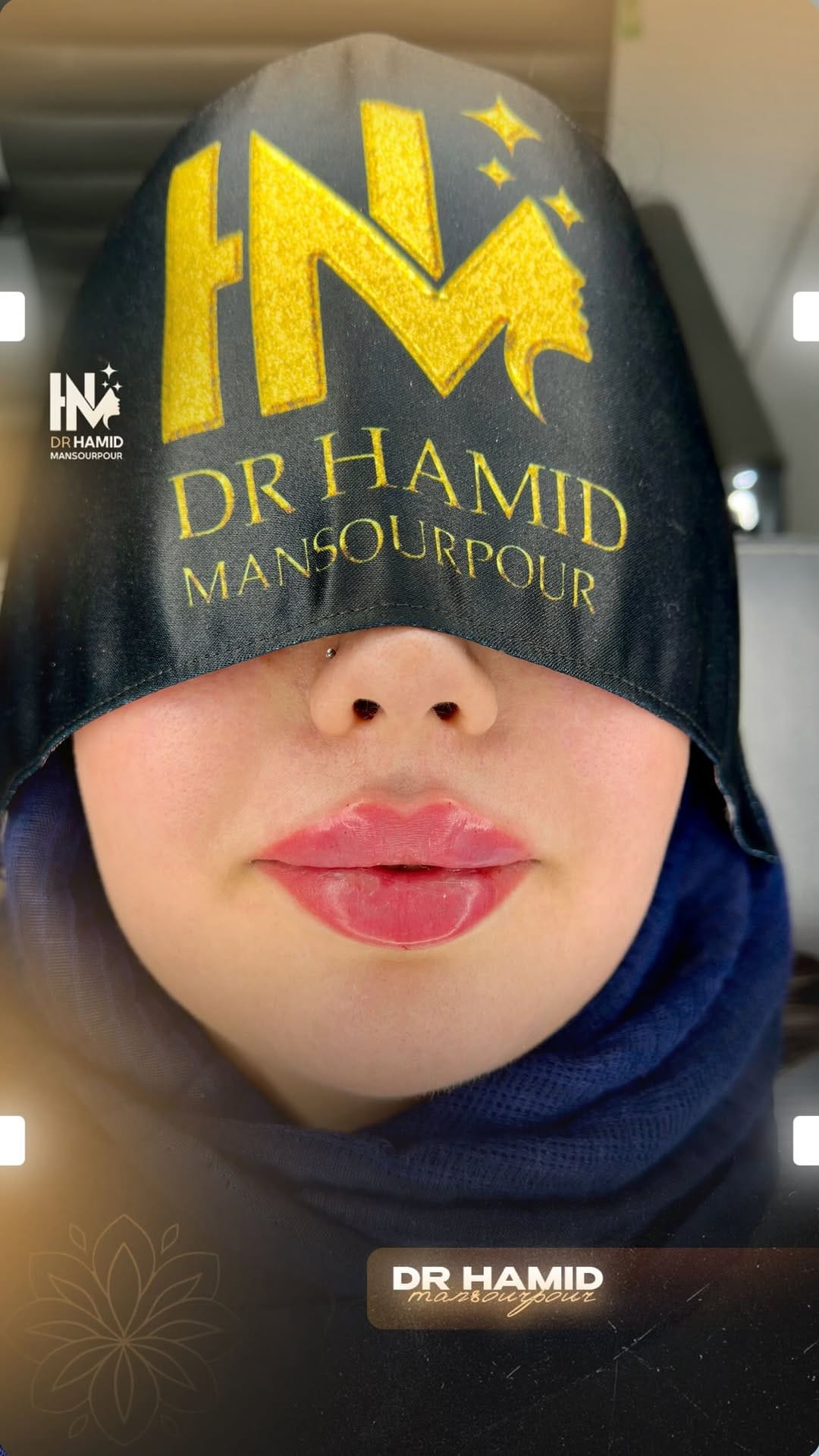 Post 8 by Dr. Hamid Mansourpour on Instagram (video)