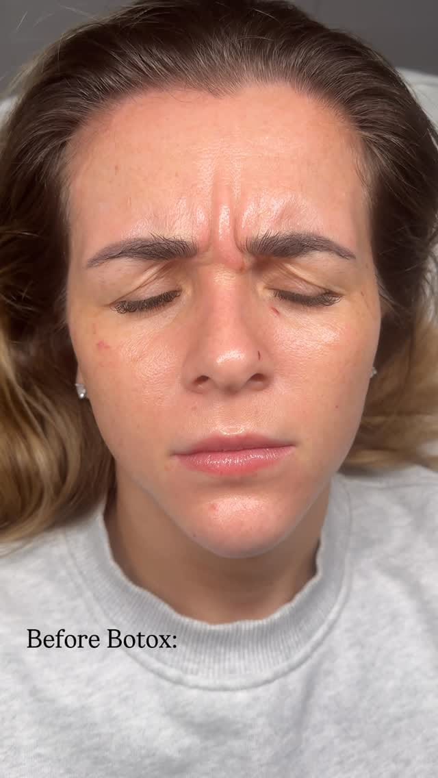Post 1 by AESTHETICS & SKIN SPECIALIST on Instagram (video)