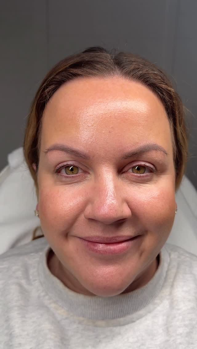 Post 2 by AESTHETICS & SKIN SPECIALIST on Instagram (video)