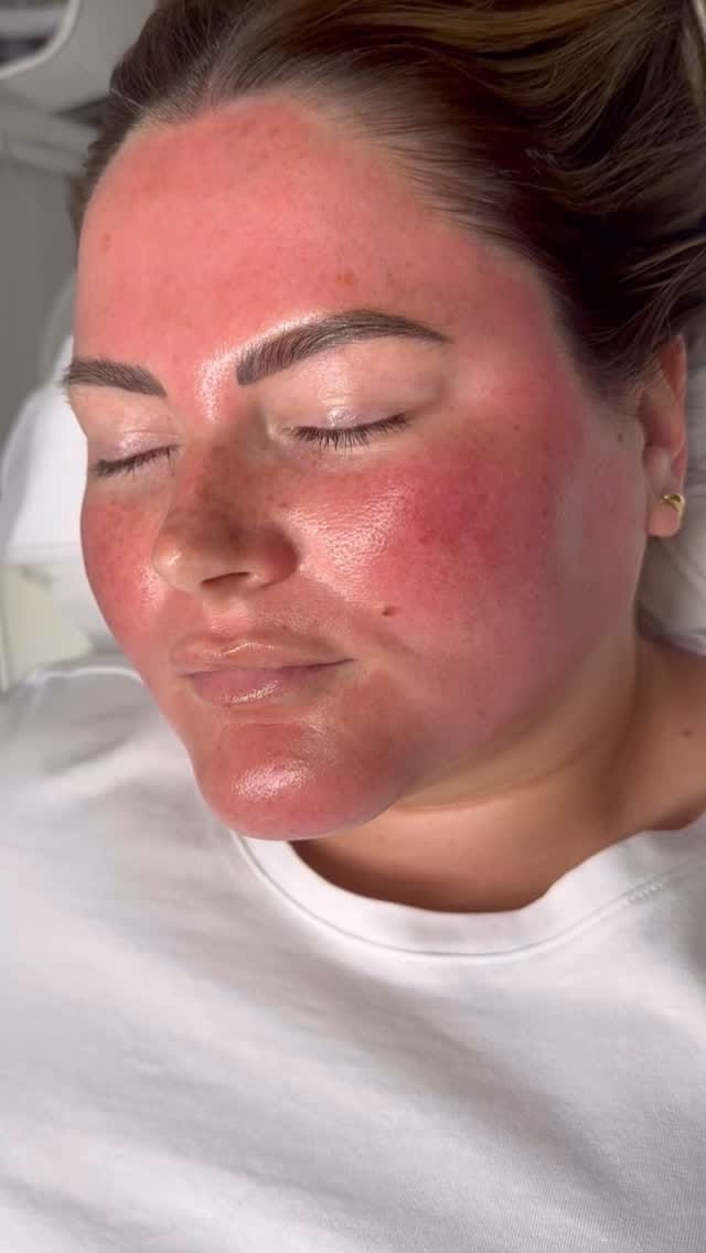 Post 9 by AESTHETICS & SKIN SPECIALIST on Instagram (video)