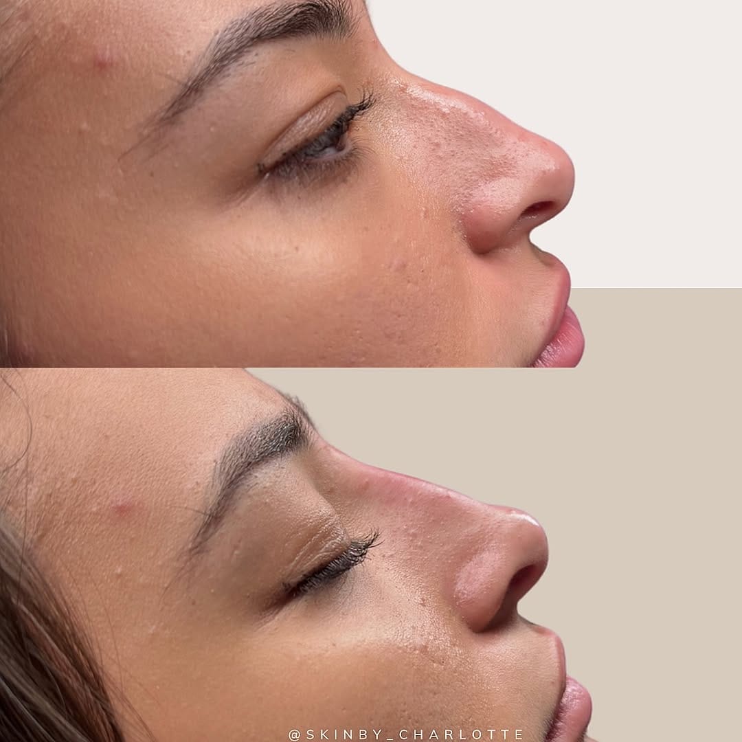 Post 5 by AESTHETICS & SKIN SPECIALIST on Instagram (image)