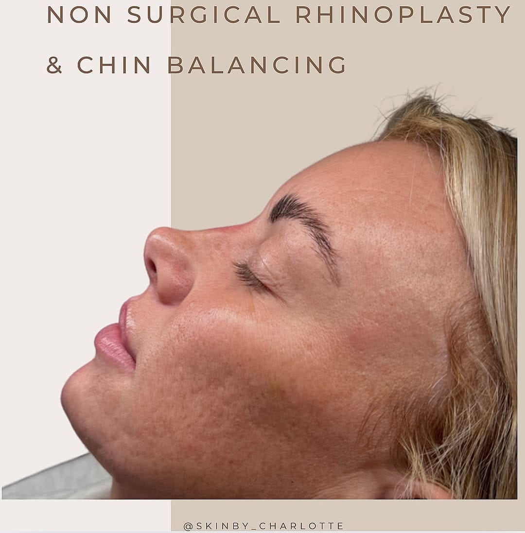 Post 7 by AESTHETICS & SKIN SPECIALIST on Instagram (image)