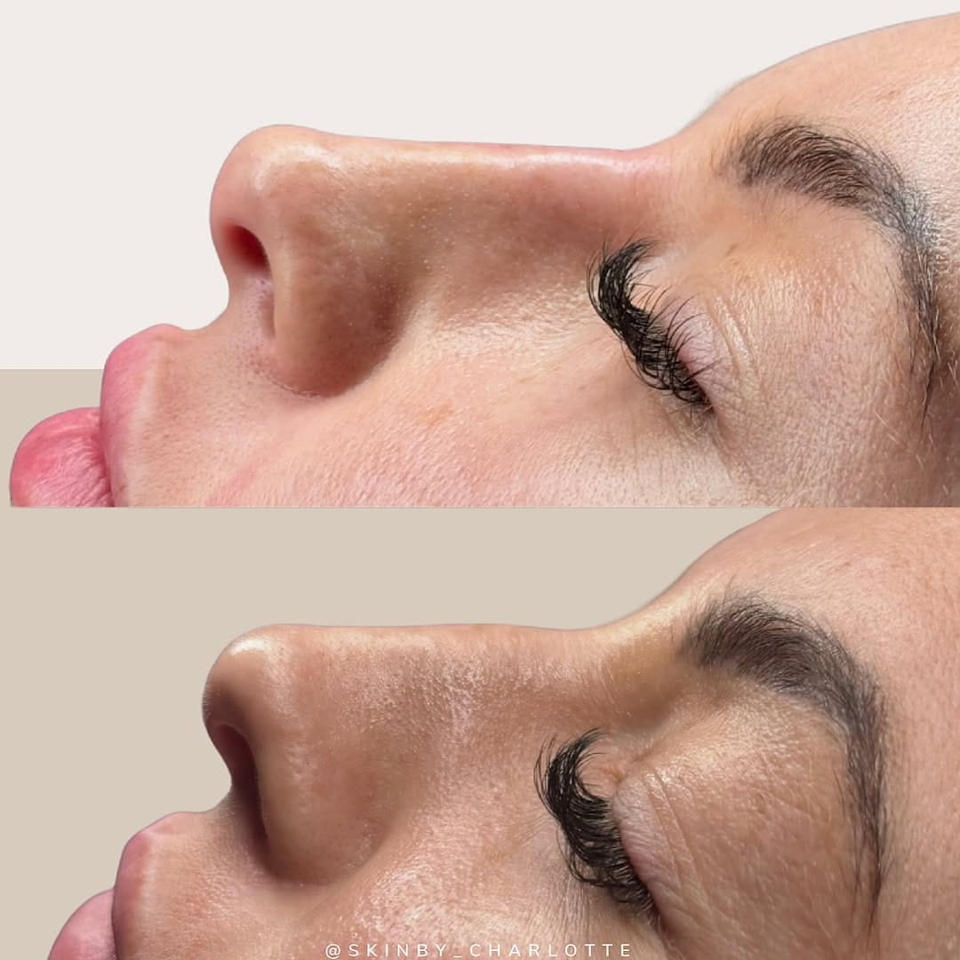 Post 3 by AESTHETICS & SKIN SPECIALIST on Instagram (image)