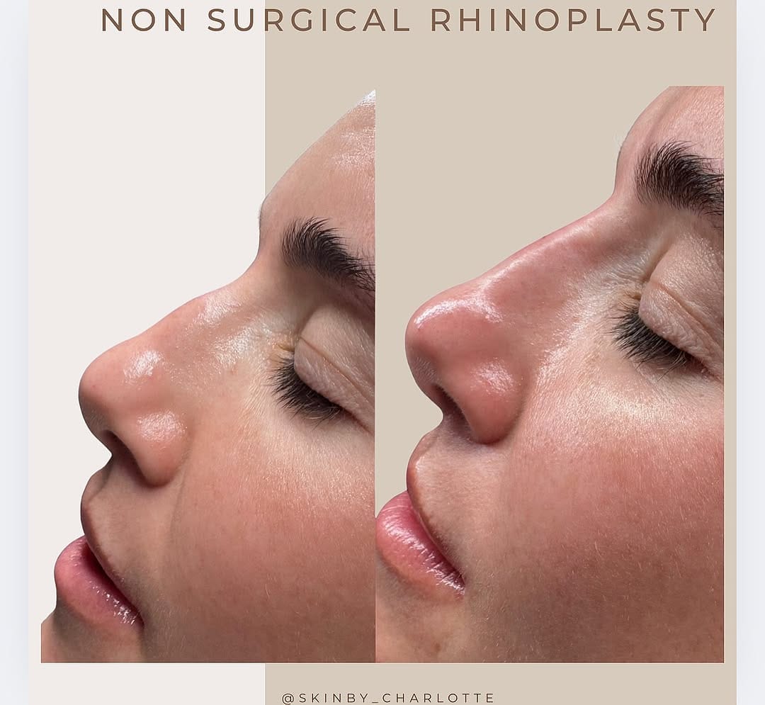 Post 6 by AESTHETICS & SKIN SPECIALIST on Instagram (image)