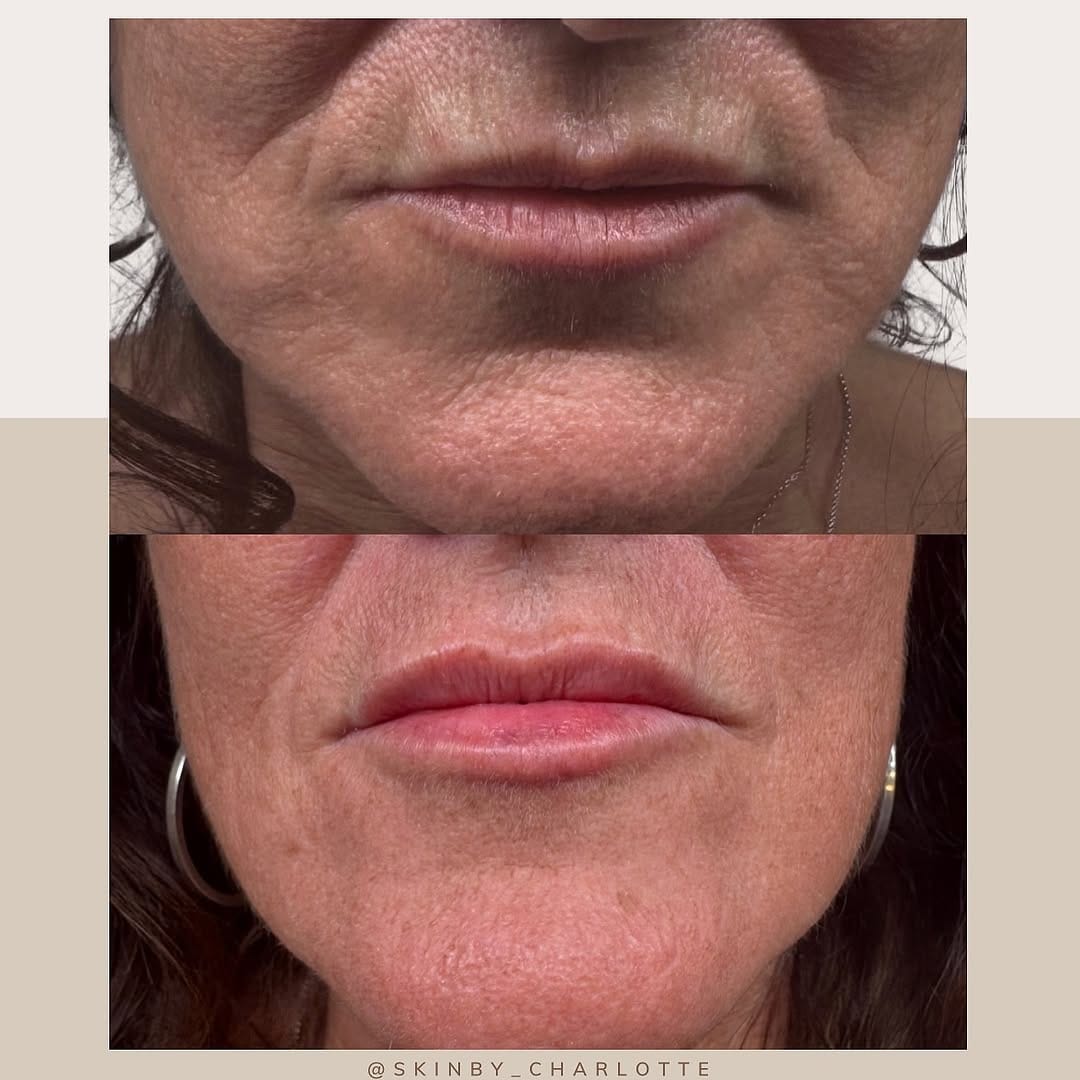 Post 8 by AESTHETICS & SKIN SPECIALIST on Instagram (image)