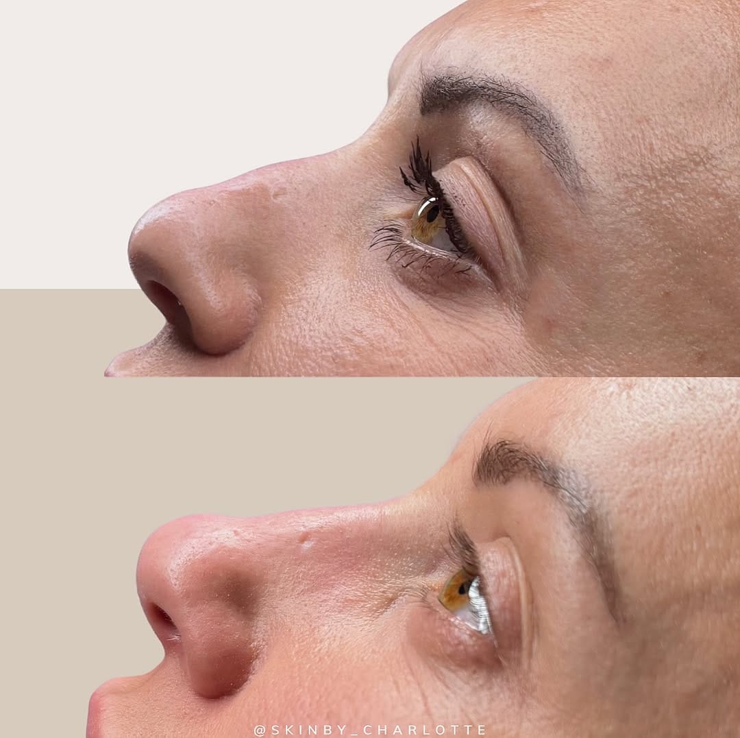 Post 4 by AESTHETICS & SKIN SPECIALIST on Instagram (image)