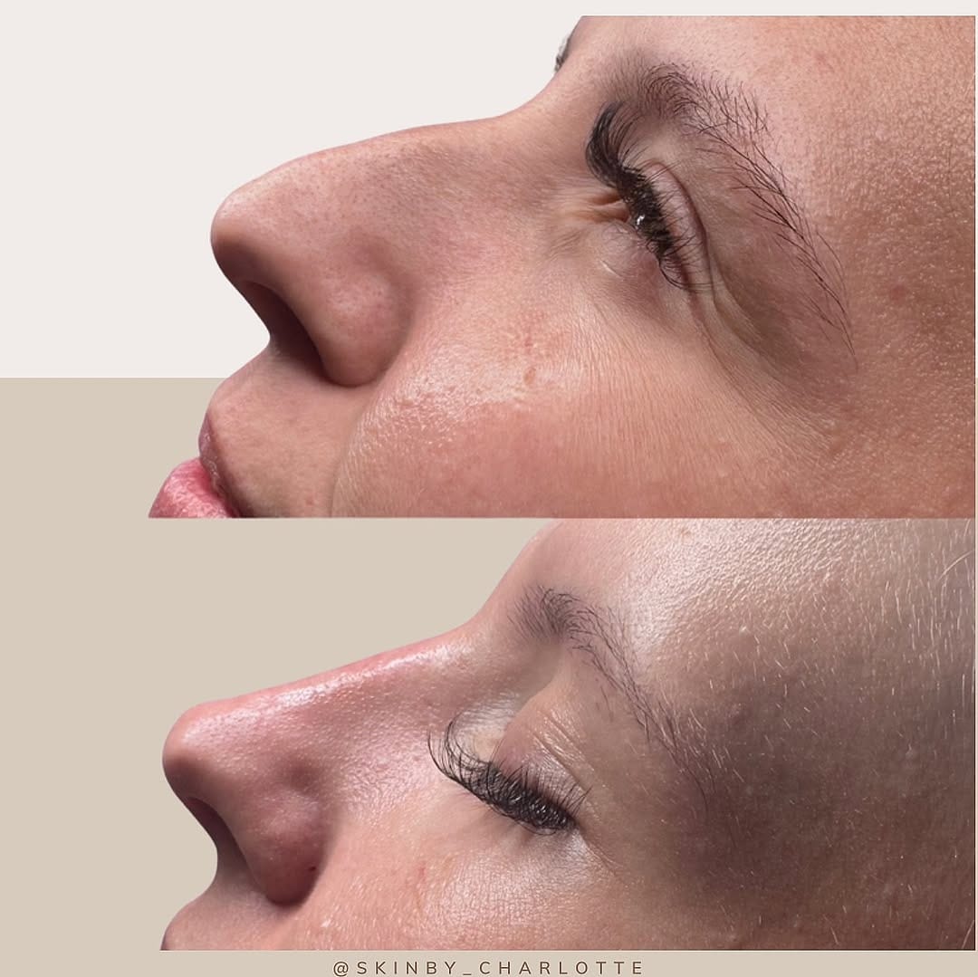 Post 10 by AESTHETICS & SKIN SPECIALIST on Instagram (image)