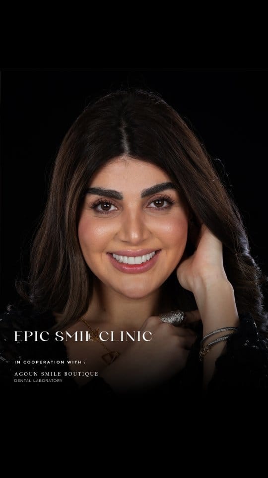 Post 9 by epic smile clinic on Instagram (video)