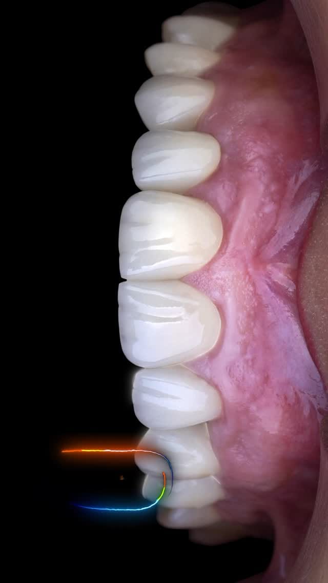 Post 7 by epic smile clinic on Instagram (video)