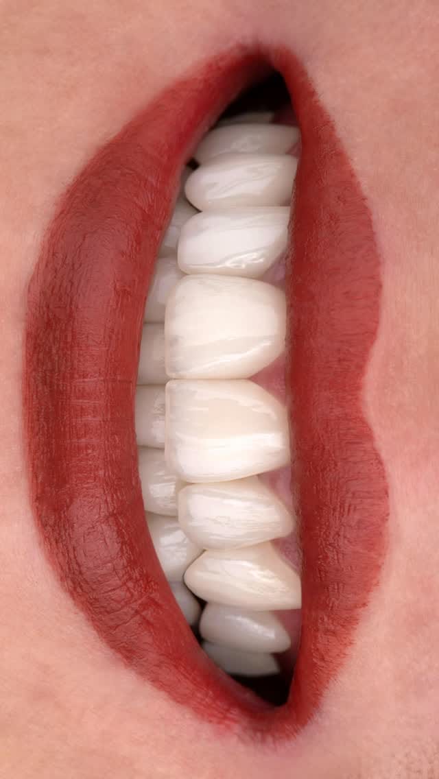 Post 6 by epic smile clinic on Instagram (video)