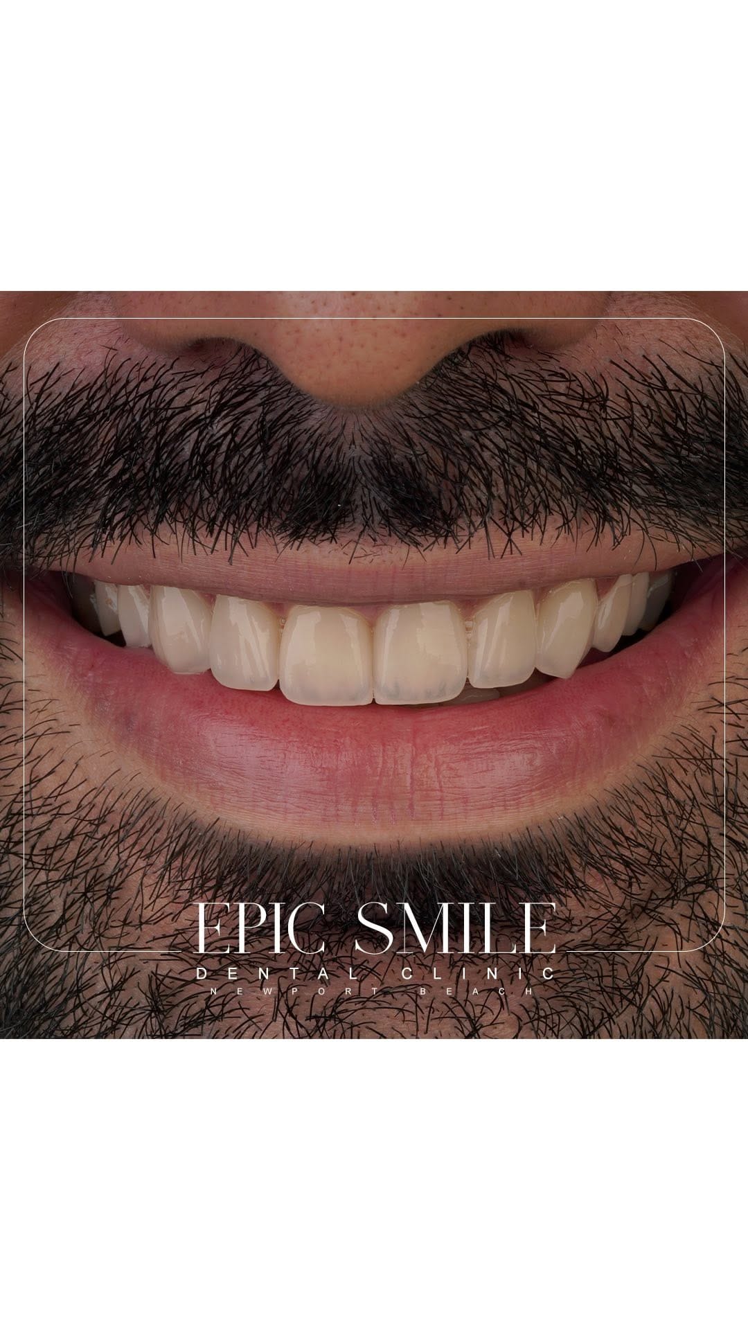 Post 10 by epic smile clinic on Instagram (video)