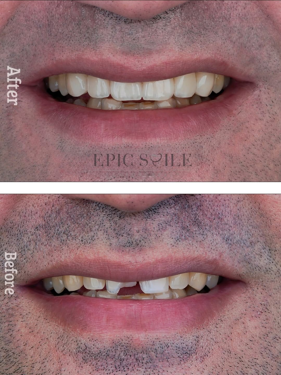 Post 2 by epic smile clinic on Instagram (carousel)