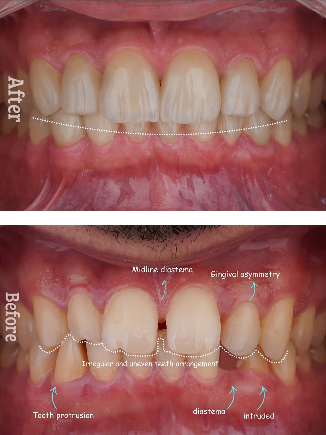 Post 1 by epic smile clinic on Instagram (carousel)