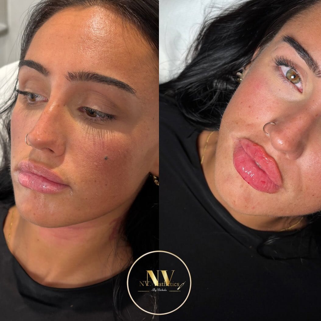Post 8 by NVAESTHETICS by Nichola Valentina on Instagram (image)