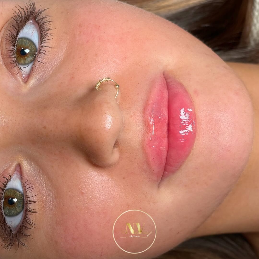 Post 9 by NVAESTHETICS by Nichola Valentina on Instagram (image)