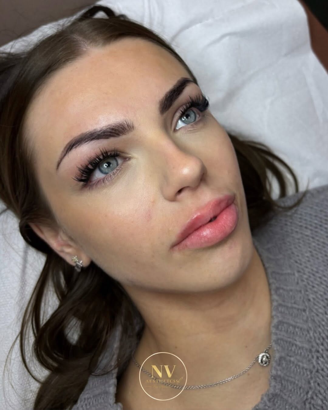 Post 2 by NVAESTHETICS by Nichola Valentina on Instagram (carousel)