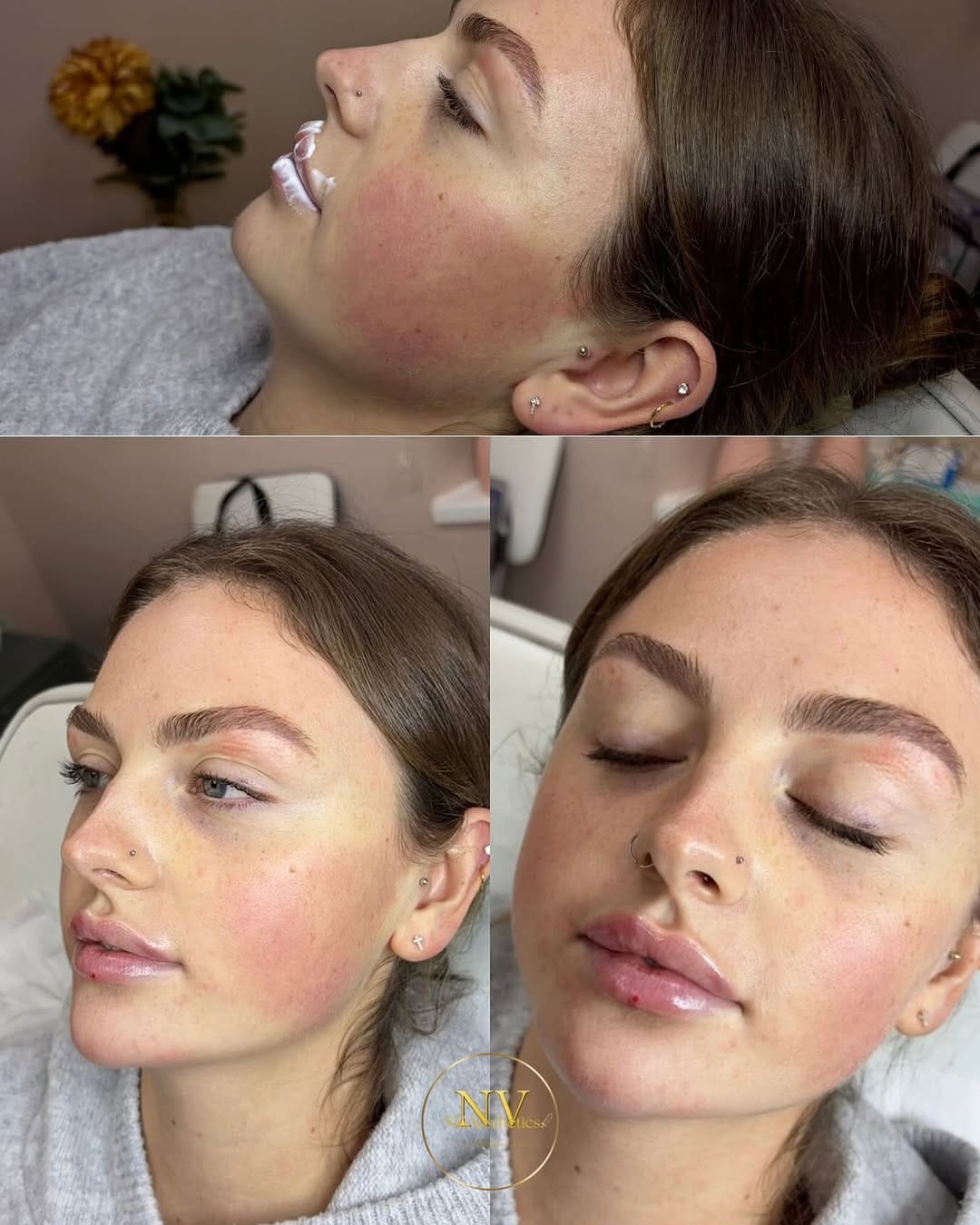 Post 7 by NVAESTHETICS by Nichola Valentina on Instagram (image)